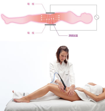 インディバとは